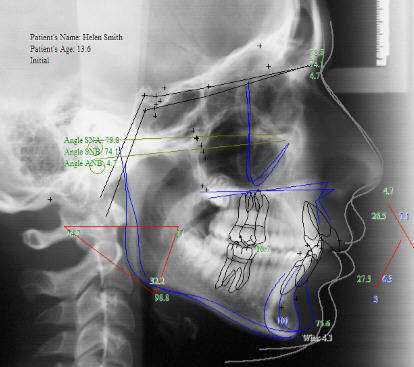 看牙齒為什么要拍片？