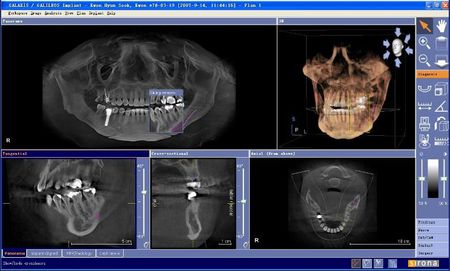 看牙齒為什么要拍片？